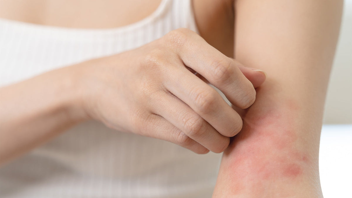 Les préservatifs sans latex : se protéger sans allergie ! - Condomz